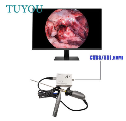 acheter Caméra électrique portable ENT-endoscope pour ordinateur portable fabrication en ligne