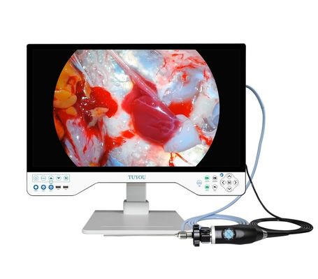 acheter Système de caméra ENT tout en un avec caméra HD endoscopique portable et source lumineuse fabrication en ligne