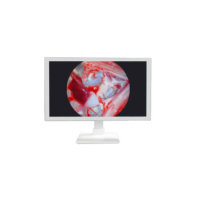 acheter Équipement médical FHD 22 24 27 pouces Moniteur de caméra d'endoscope Affichage Moniteur médical Full HD fabrication en ligne
