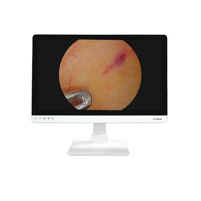 acheter Équipement médical 4K FHD 27 pouces Endoscope Caméra Moniteur d'affichage Pour Endoscope fabrication en ligne