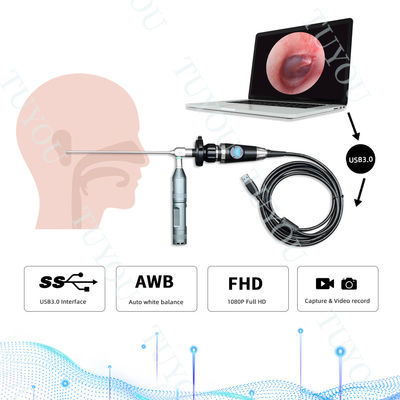 acheter Appareil photo portable USB3.0 pour l' endoscopie pour l' inspection médicale ORL fabrication en ligne