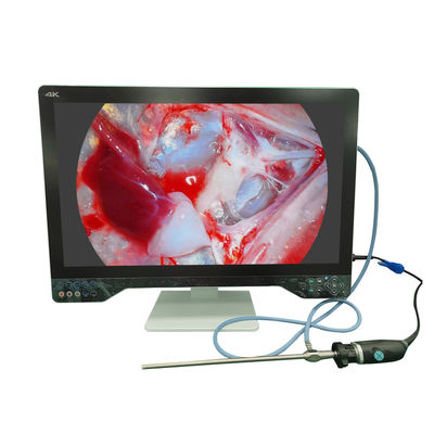 acheter Caméra endoscopique 4K ultra haute définition pour la laparoscopie avec moniteur 32 