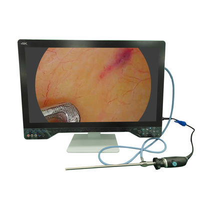 acheter Système de caméra d'endoscopie médicale 4K de 32 pouces avec fonction laparoscopique USB fabrication en ligne