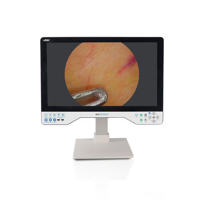acheter 24 pouces moniteur laparoscopique 4K système de caméra endoscopique UHD LED chirurgicale avec source lumineuse fabrication en ligne