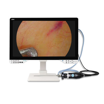 acheter 27 pouces Endoscope 4K pour chirurgie laparoscopique avec source lumineuse et moniteur fabrication en ligne