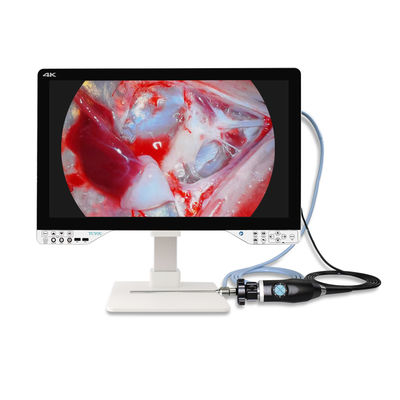 acheter AC110V-250V appareil photo d'endoscopie ORL médical 4K avec source lumineuse et moniteur fabrication en ligne