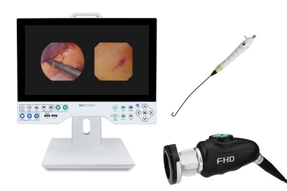 acheter TUYOU Outil de chirurgie du cerveau tout-en-un Système de caméra endoscopique rigide et flexible pour les examens utérins fabrication en ligne