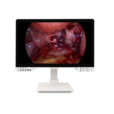 acheter 27 pouces FHD 1080P Système de caméra endoscopique Endoscope rigide avec moniteur et puissance optique efficace de 100W fabrication en ligne