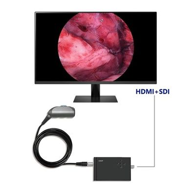 acheter Caméra vidéo d'endoscopie portable TUYOU Full HD 1920x1080 Résolution 120 degrés Champ de vision pour urologie de la colonne vertébrale et chirurgie ORL fabrication en ligne