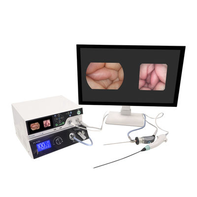 acheter TUYOU Manufacturer Equipement d'imagerie 1080P avec système de caméra d'endoscopie rigide et flexible pour ORL fabrication en ligne