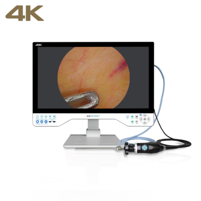 acheter Système de caméra d'endoscopie FHD tout-en-un TUYOU avec moniteur chirurgical de 24 pouces pour les procédures d'urologie fabrication en ligne