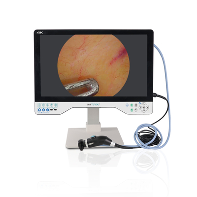 acheter TU-24LSD1A  Caméra d'endoscopie médicale 4K 24 pouces 4K avec batterie 8h IPX8 fabrication en ligne