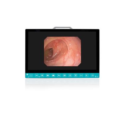acheter TUYOU 13,3 pouces FHD Système de caméra endoscopique flexible Multi-couleur OEM personnalisé tout-en-un Portable Uro-Gyn TikTok Hit fabrication en ligne