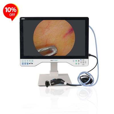 acheter All-in-one Camera System With 24 Inches Monitor For Laparoscopy ENT Surgery Manufacturer  fabrication en ligne