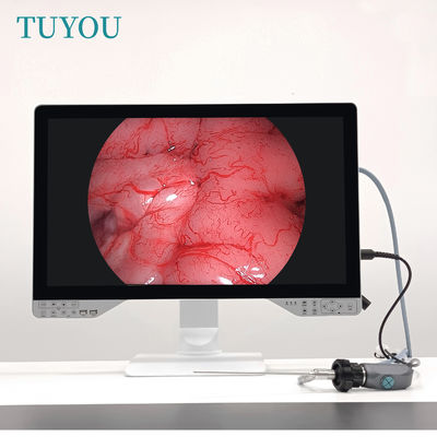 Disque U 27 pouces 1080P Full HD 4 en 1 Système d' arthroscope médical Hystéroscope Endoscope Caméra