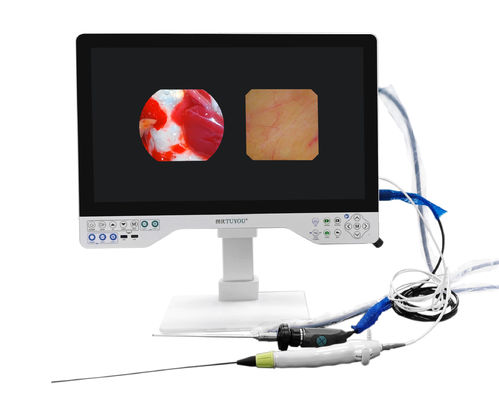 Caméra endoscopique Full HD TUYOU 1/2.8