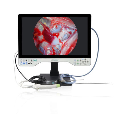 Tout en un système double flexible et rigide 24 pouces système de caméra d'endoscope FHD
