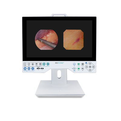 TUYOU Full HD 1080P 15,6 pouces tout en un système de caméra d'endoscopie médicale pour l'urologie des sinus ORL