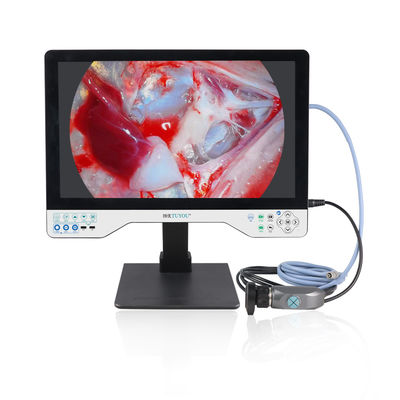 Laparoscopie Cystoscope Chirurgie 24 pouces HD Endoscopie Source lumineuse LED Endoscope Caméra avec fonction d'enregistrement