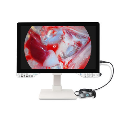 Kit de caméra d'endoscopie chirurgicale Full HD avec source lumineuse et moniteur de 27 pouces pour gynécologie