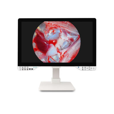 Caméra d'endoscopie médicale Full HD de 27 pouces pour chirurgie gynécologique avec source lumineuse et moniteur