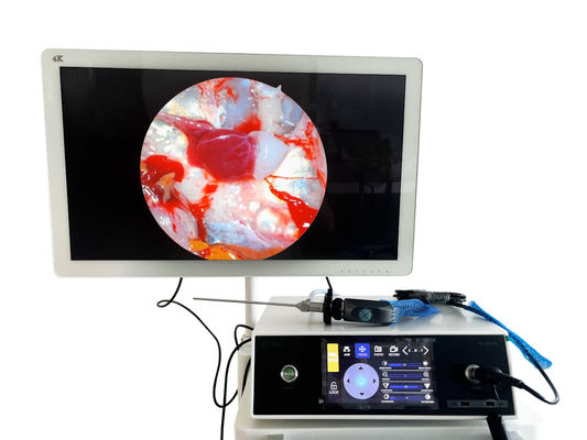 Caméra d'endoscopie portable ENT Full HD 1080P avec écran tactile et source lumineuse LED