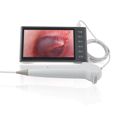 ORL Chirurgie Blanc FHD Flexible numérique visuel écouteur électronique outil d'élimination du cérumen Endoscope jetable Caméra 7 pouces écran IPS