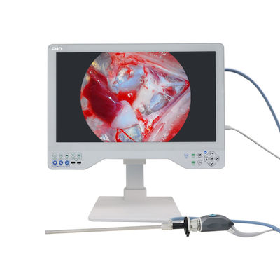 Système de caméra d'endoscopie médicale tout-en-un avec imagerie Full HD pour les ORL et la laparoscopie