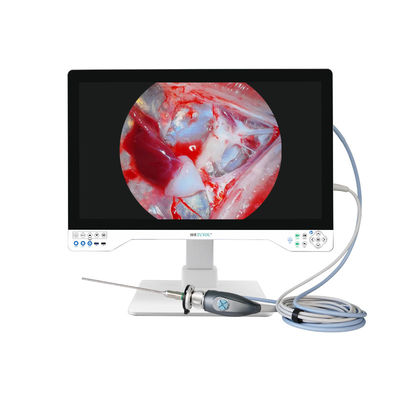 Système de caméra d'endoscopie rigide TUYOU 4K pour le foie de fenestration des kystes avec résolution HDMI 3840P et capteur CMOS SONY de 1/2.8 