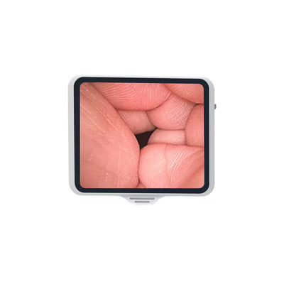 Endoscope flexible TUYOU avec écran de 3,5 pouces, réutilisable pour la bronchoscopie en fibre optique et la santé des animaux de compagnie