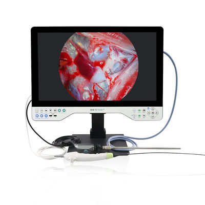 Système de caméra d'endoscope 4K tout-en-un, lumière LED intégrée et portée flexible pour la laparoscopie