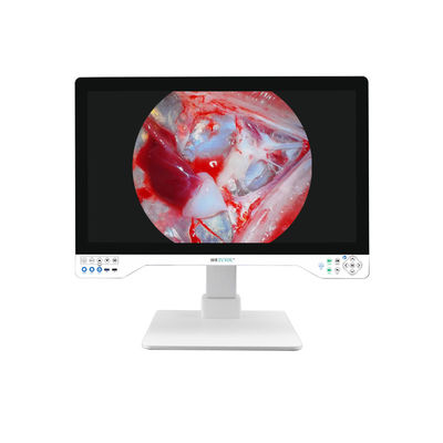 Caméra d'endoscopie 4K de 32 pouces avec source lumineuse intégrée et affichage pour système laparoscopique