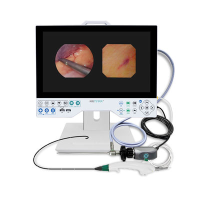 TUYOU Outil de chirurgie du cerveau tout-en-un Système de caméra endoscopique rigide et flexible pour les examens utérins