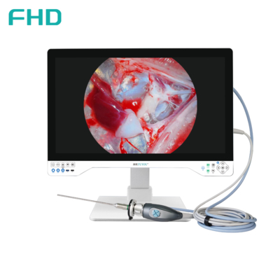 Système de caméra d'endoscope 4K tout en un Éclairage LED intégré avec moniteur médical 32 pouces