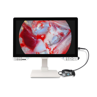 Système de caméra d'endoscope FHD de 27 pouces avec lumière LED de 100 W pour chirurgie ORL