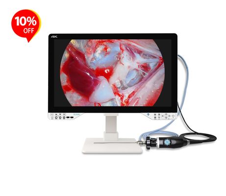 Système de caméra endoscopique tout-en-un de 27 pouces avec une puissance optique efficace de 100 W pour la chirurgie ORL et l'urologie laparoscopique