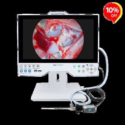 Economical Full HD All-in-One Endoscope Camera System - CE Certified Integrated Monitor for Laparoscopy/Gynecology Exams
