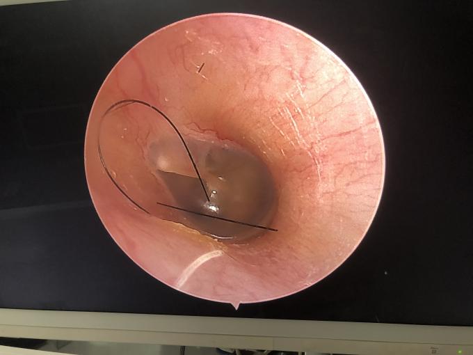 Moniteur LCD portable tout en un HD Endoscopie Caméra Pour ENT Laparoscopie Hystéroscopie Urologie 2