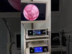 Système de caméra fonctionnelle d'enregistrement vidéo 4K