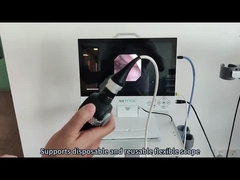 Système de caméra d'endoscopie tout-en-un TU-15LSD1C avec imagerie Full HD pour les ORL et la laparoscopie