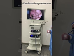 TU-D100A Caméra endoscopique 4K ultra haute définition pour chirurgie nasale, auditive et laparoscopique