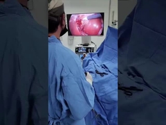 Système de caméra TU-LSD90TB 2 en 1 avec source lumineuse froide pour la laparoscopie et les ENT