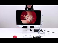 24 pouces TUYOU Nasopharyngoscope Endoscope Caméra d'enregistrement pour les chirurgies de laparoscopie haute définition