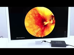 TU-Y5D101B Caméra d'endoscopie Full HD avec lumière réglable pour chirurgie ORL et laparoscopique