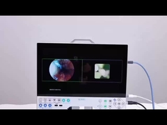 TUYOU 15.6 Full HD 1080P All In One Système de caméra d'endoscopie médicale pour l'urologie des sinus ORL